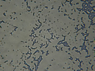 Aeromonas hydrophila onder microscoop